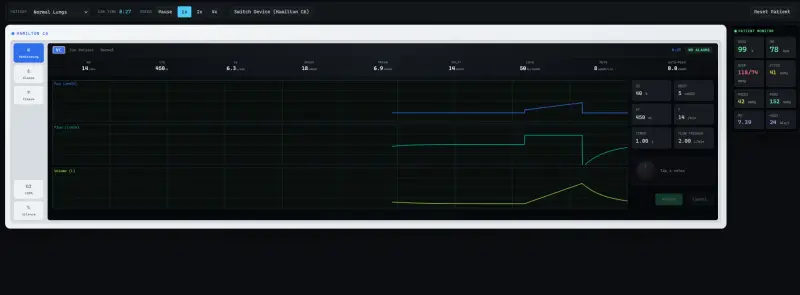 VentSim ventilator training simulator — screenshot 3